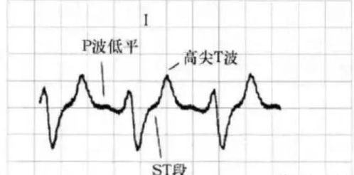 心电图吃瓜视频,揭秘心电图背后的趣味与知识