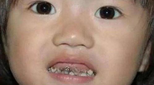 爆牙吃瓜搞笑视频,笑料横生的搞笑视频集锦